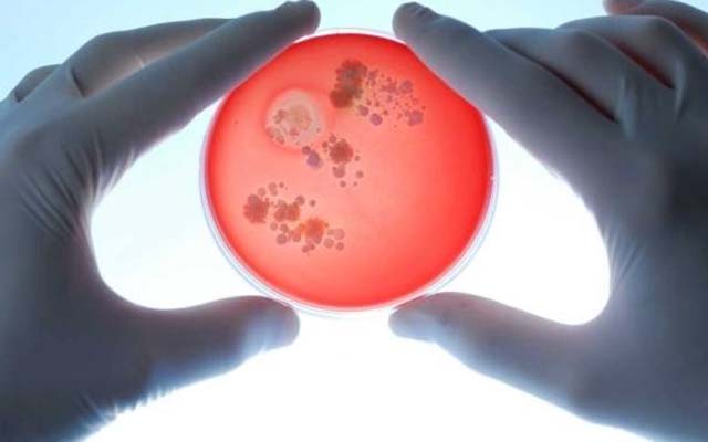 農用微生物菌劑里的微生物說的是什么